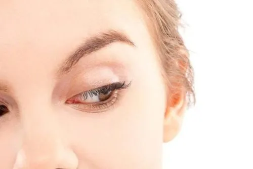 如何预防眼部皱纹 眼部皱纹形成的原因