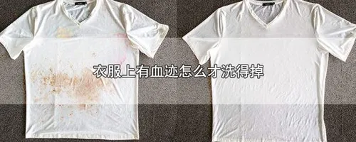 衣服上有血迹怎么才洗得掉