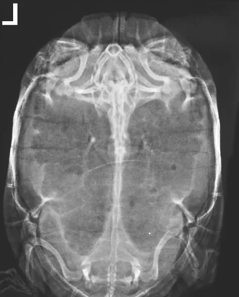 科学诊治龟病的时代幕布已经拉开