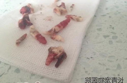 犬猫牙龈炎牙根腐烂导致的颜面瘘