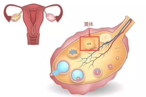 黄体破裂可以自愈吗