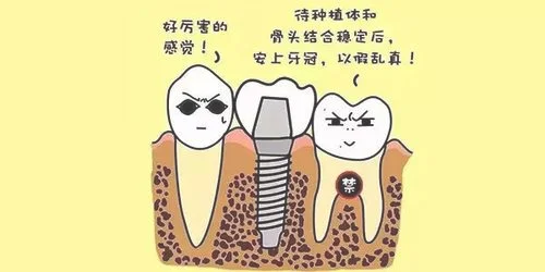 1、种植牙，即是将人工牙根植入到缺牙区外的牙槽骨中，通过人工牙根，在种植体内部上植入人工牙根，从而形成牙冠，不仅能修复缺失牙，还能达到很好的美观效果。