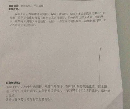 得了肺结核却意外怀孕了怎么办