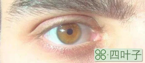 琥珀色眼睛是什么血统