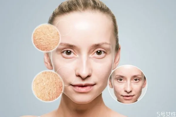 如何延缓皮肤衰老 延缓皮肤衰老的方法