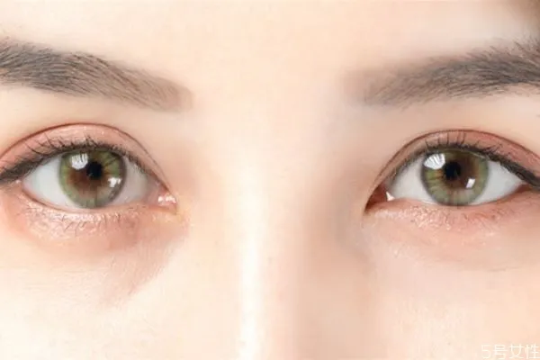 眼皱纹怎么减少 眼皱纹细纹去除办法