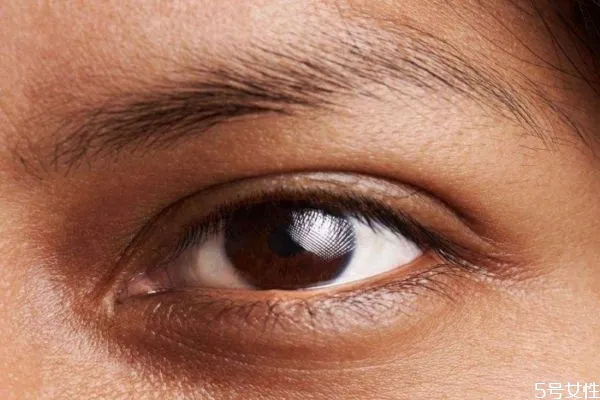 眼部干纹是怎么形成的 为什么会造成眼部干纹