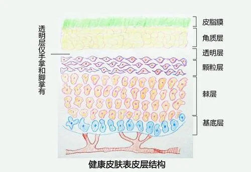 如何修复过薄的角质层 角质层薄的表现