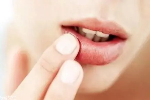 唇部磨砂膏什么时候用 唇部磨砂膏使用频率